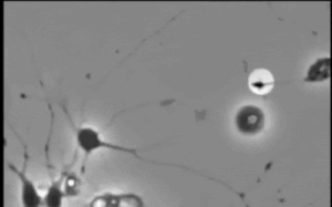 Neurogenesis